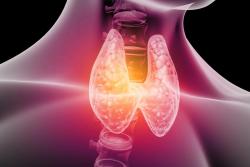 Hypothyroidism - A holistic approach to thyroid health